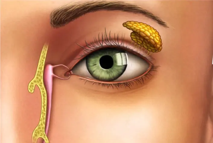 cirugía de vías lagrimales